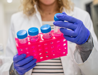 Woman wearing a lab coat and gloves she is examing science tubes.